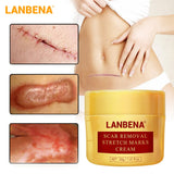 LANBENA Acne Scar Removal Cream Acne Spots Repair Acne Treatment Blackhead Whitening Stretch Marks Skin Care Bleaching Cream