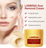 LANBENA Acne Scar Removal Cream Acne Spots Repair Acne Treatment Blackhead Whitening Stretch Marks Skin Care Bleaching Cream - Virtual Blue Store
