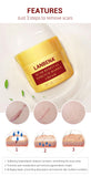 LANBENA Acne Scar Removal Cream Acne Spots Repair Acne Treatment Blackhead Whitening Stretch Marks Skin Care Bleaching Cream - Virtual Blue Store